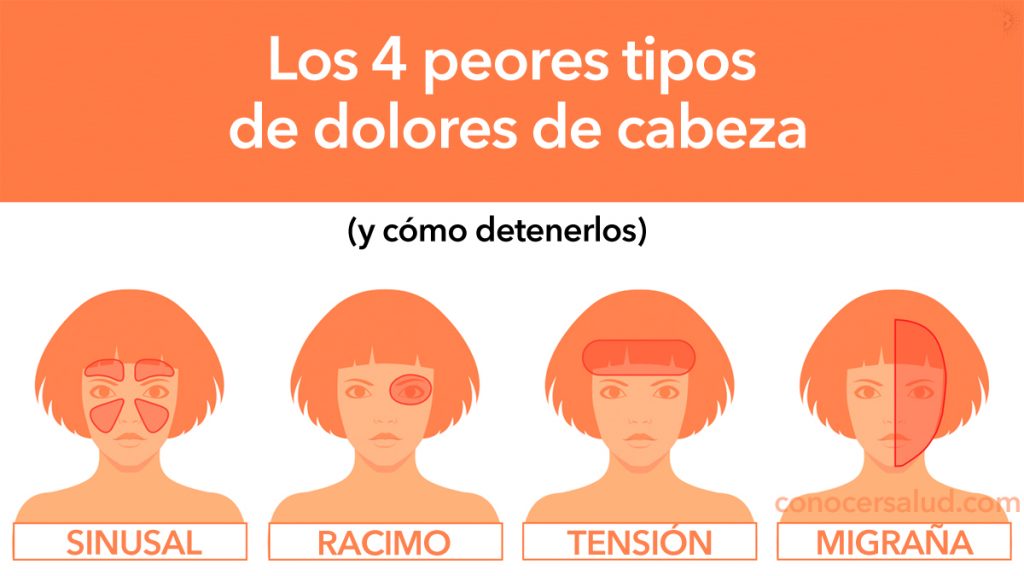 Médicos explican los 4 peores tipos de dolores de cabeza (y cómo detenerlos)