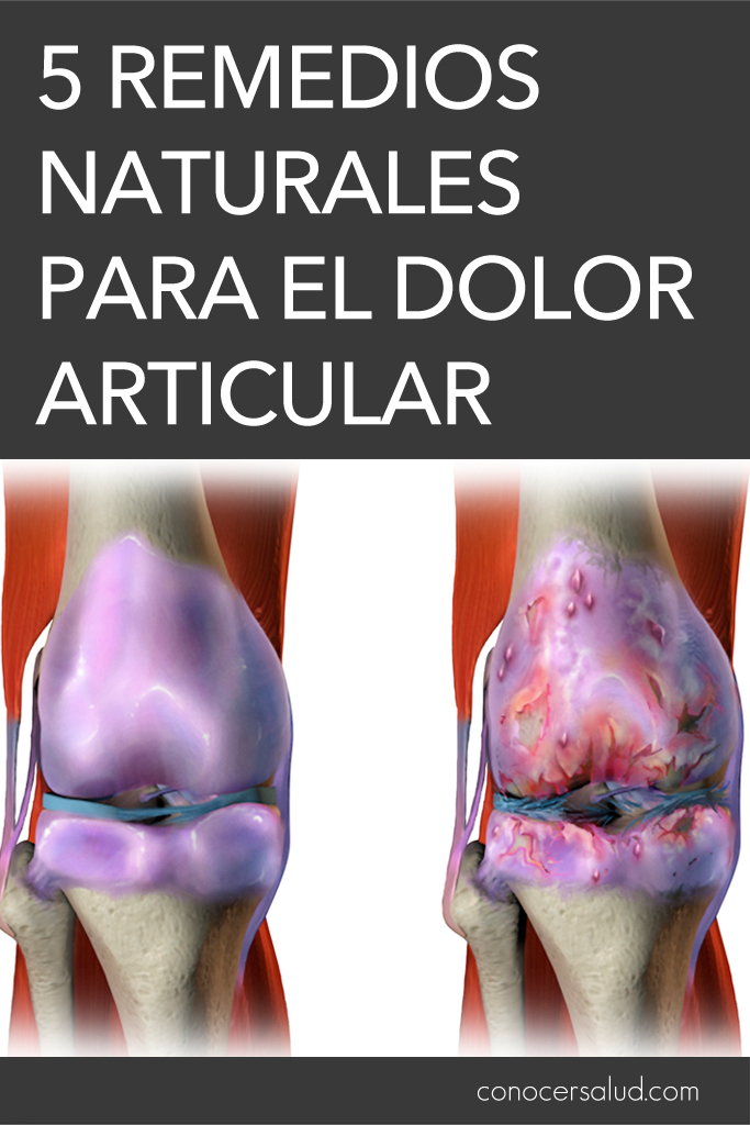 5 remedios naturales para el dolor articular