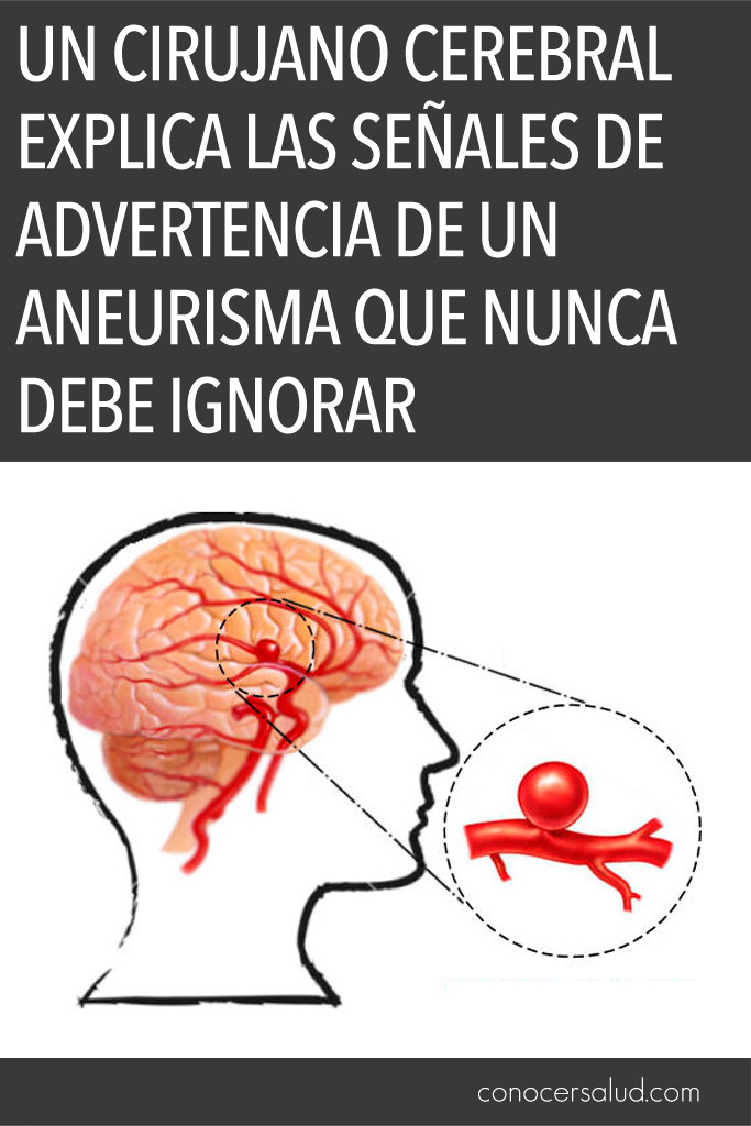 Un cirujano cerebral explica las señales de advertencia de un aneurisma que nunca debe ignorar