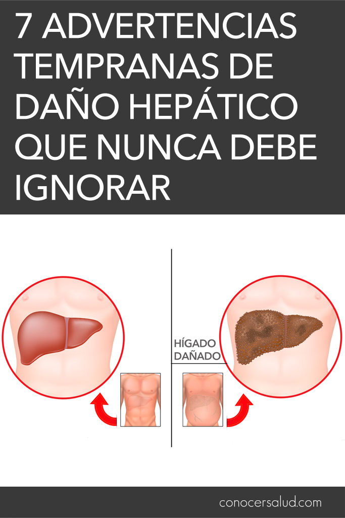 7 Advertencias tempranas de daño hepático que nunca debe ignorar