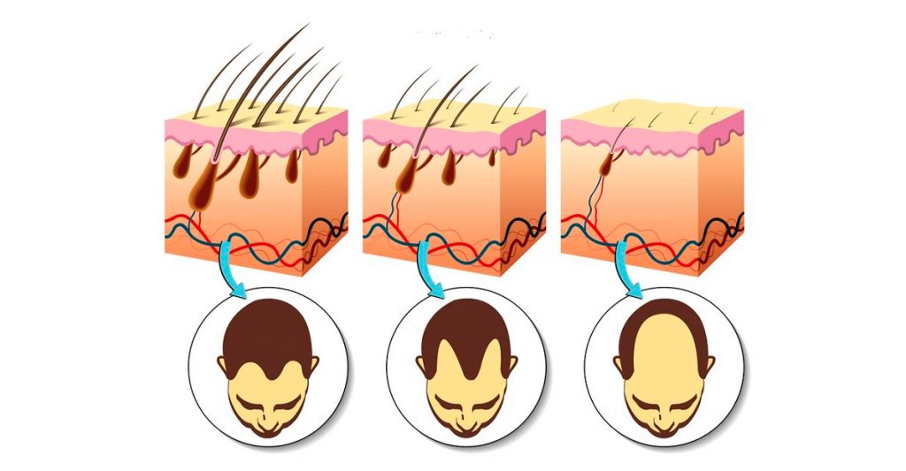 Las 5 vitaminas más importantes para estimular eficazmente el crecimiento del cabello