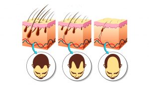 Las 5 vitaminas más importantes para estimular eficazmente el crecimiento del cabello