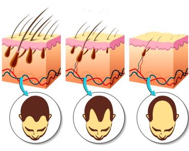 Las 5 vitaminas más importantes para estimular eficazmente el crecimiento del cabello