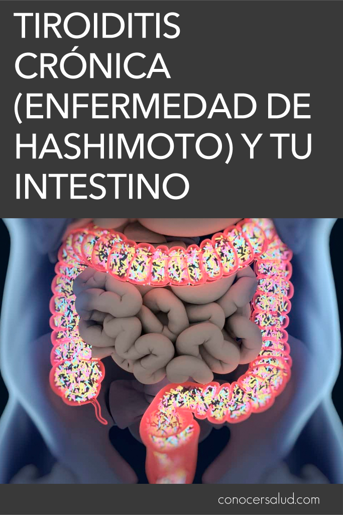 Tiroiditis crónica (enfermedad de Hashimoto) y tu intestino