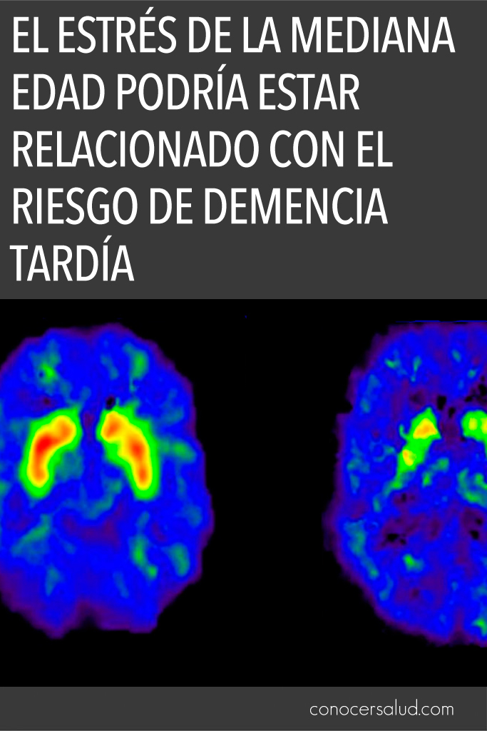 El estrés de la mediana edad podría estar relacionado con el riesgo de demencia tardía