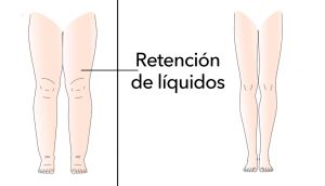 5 Razones por las que su cuerpo retiene líquidos (y cómo evitarlo)