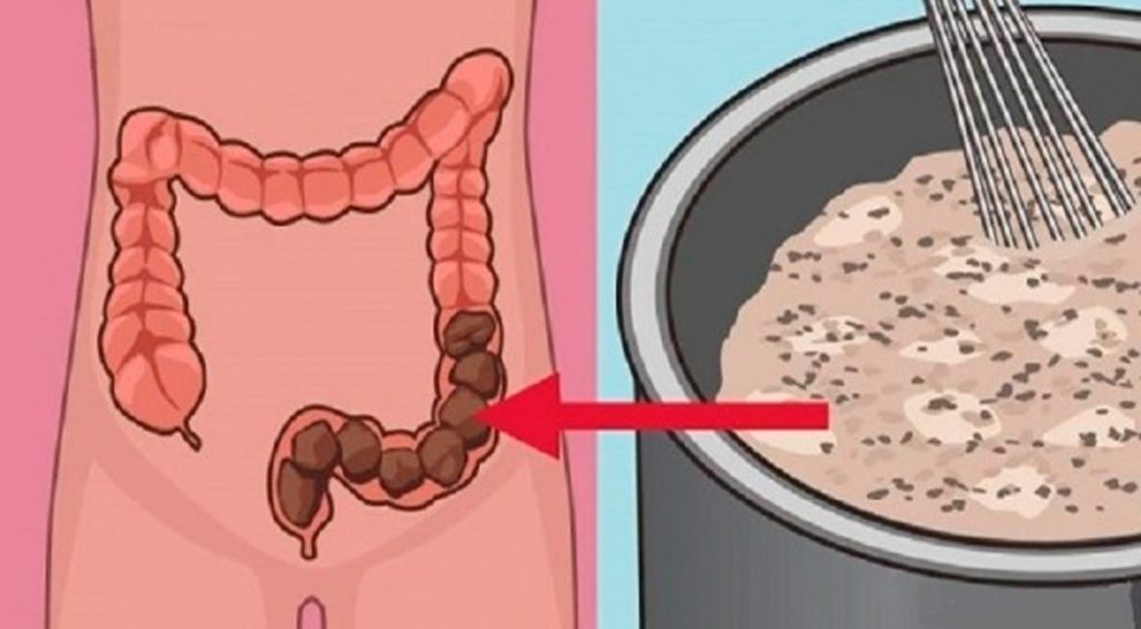 8 consejos para una limpieza natural de colon desde adentro hacia afuera