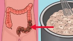 8 consejos para una limpieza natural de colon desde adentro hacia afuera