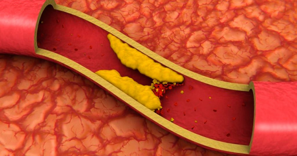 10 consejos para reducir naturalmente el colesterol