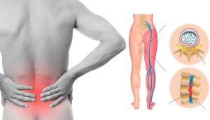 8 estiramientos de la ciática que previenen y alivian el dolor de cadera y espalda baja