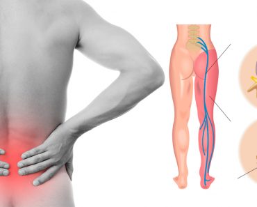 8 estiramientos de la ciática que previenen y alivian el dolor de cadera y espalda baja