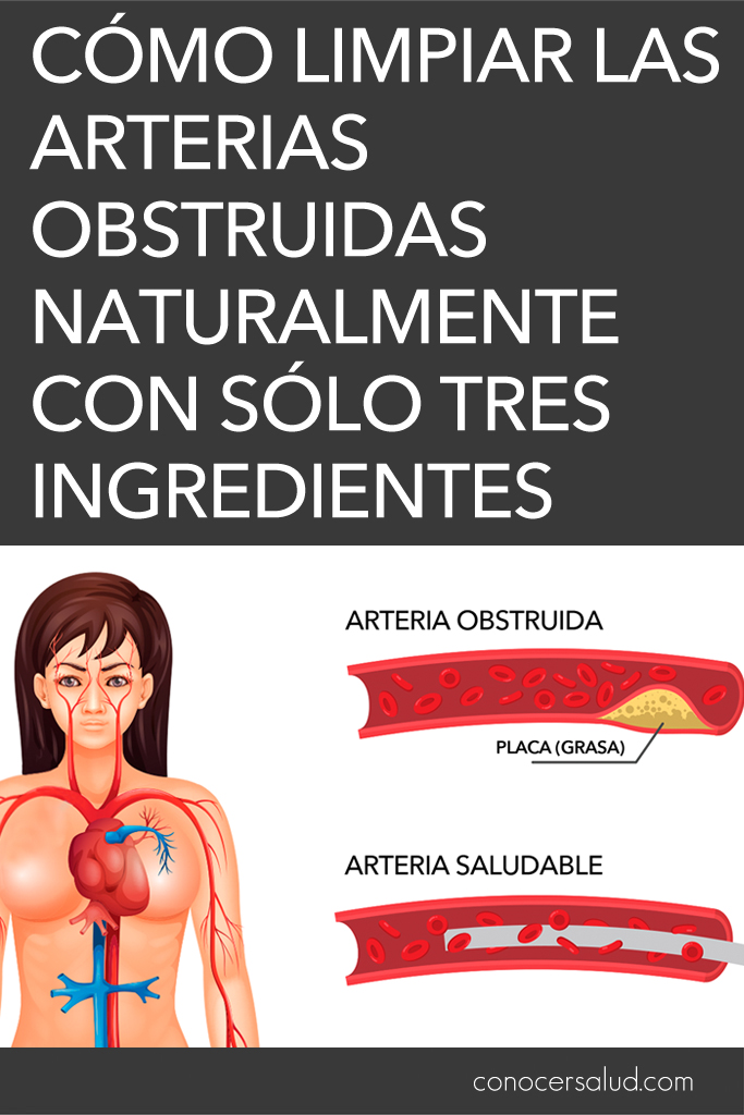 Cómo limpiar las arterias obstruidas naturalmente con sólo tres ingredientes