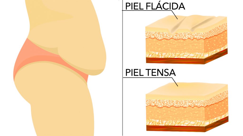 11 maneras fáciles de tensar la piel de forma natural