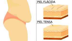 11 maneras fáciles de tensar la piel de forma natural