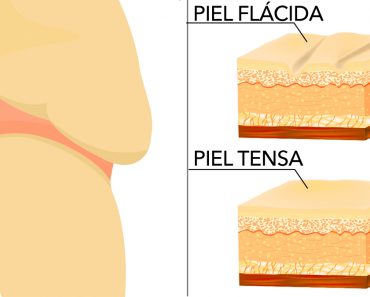 11 maneras fáciles de tensar la piel de forma natural