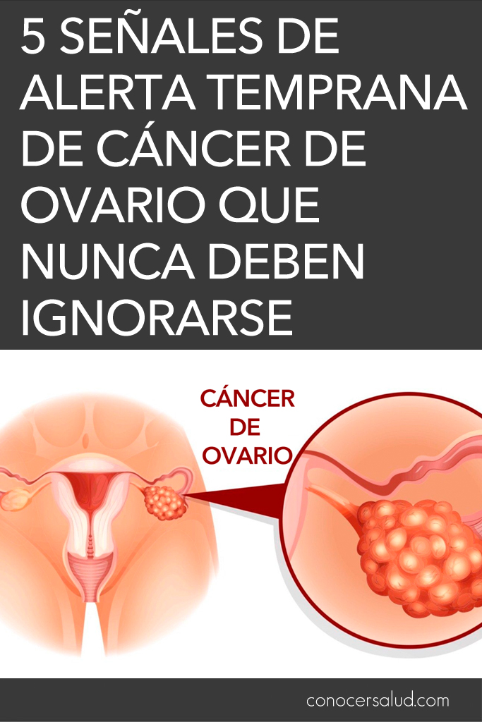 5 Señales de alerta temprana de cáncer de ovario que nunca deben ignorarse