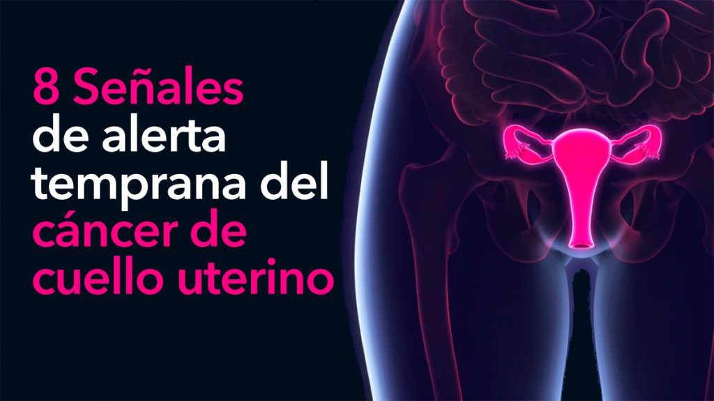 8 Señales de alerta temprana del cáncer de cuello uterino