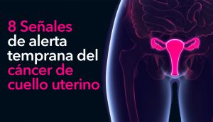 8 Señales de alerta temprana del cáncer de cuello uterino