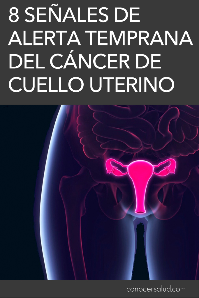 8 Señales de alerta temprana del cáncer de cuello uterino