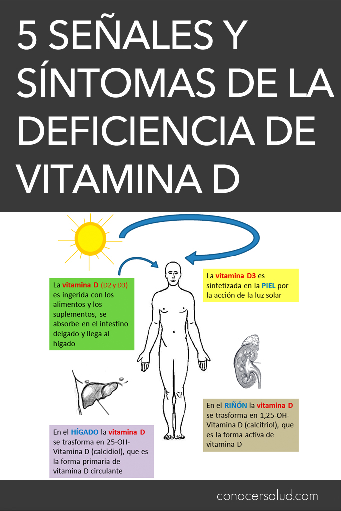 5 señales y síntomas de la deficiencia de vitamina D
