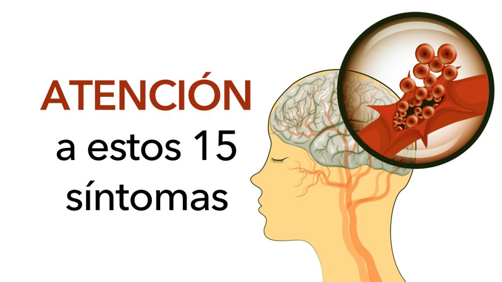 Prevenga un derrame cerebral: 15 síntomas de apoplejía que nunca hay que pasar por alto