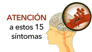 Prevenga un derrame cerebral: 15 síntomas de apoplejía que nunca hay que pasar por alto