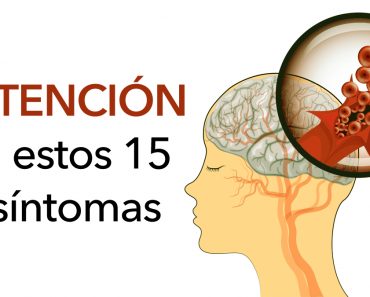 Prevenga un derrame cerebral: 15 síntomas de apoplejía que nunca hay que pasar por alto