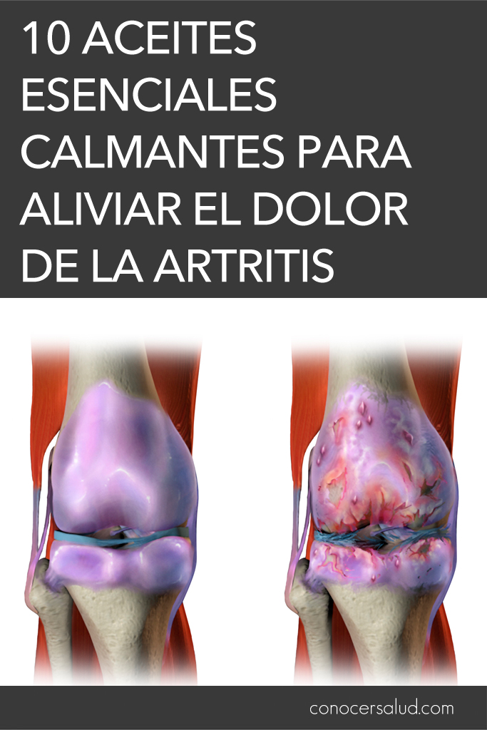 10 aceites esenciales calmantes para aliviar el dolor de la artritis