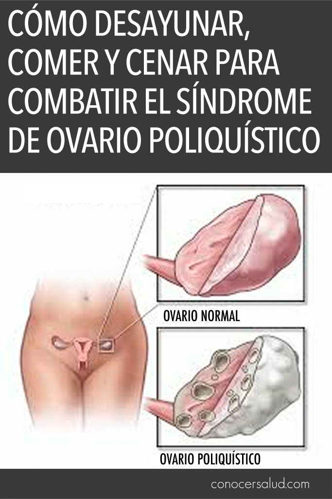 Cómo desayunar, comer y cenar para combatir el síndrome de ovario poliquístico