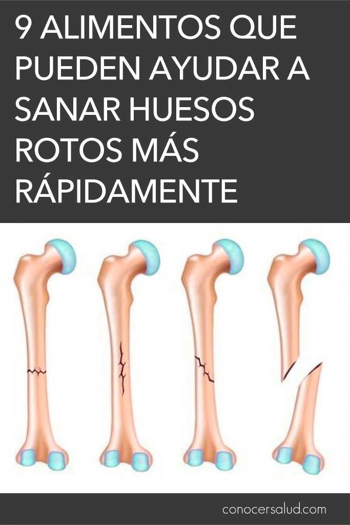 pavimento si puedes experiencia 9 Alimentos que pueden ayudar a sanar huesos rotos más rápidamente