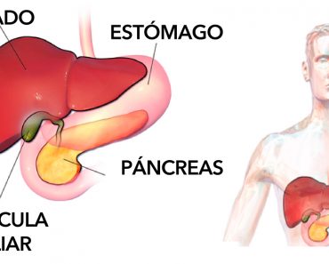 6 grandes alimentos que pueden ayudar a prevenir los cálculos biliares