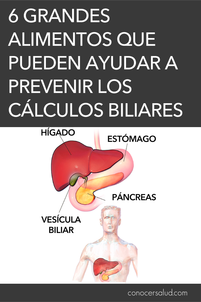 6 grandes alimentos que pueden ayudar a prevenir los cálculos biliares