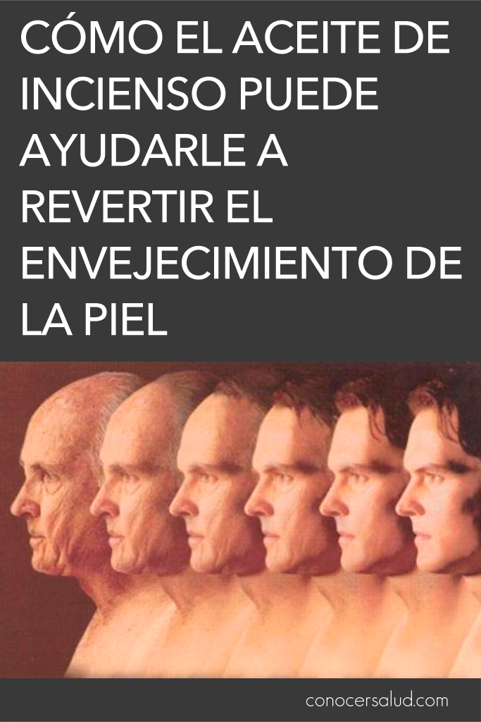 Cómo el aceite de incienso puede ayudarle a revertir el envejecimiento de la piel