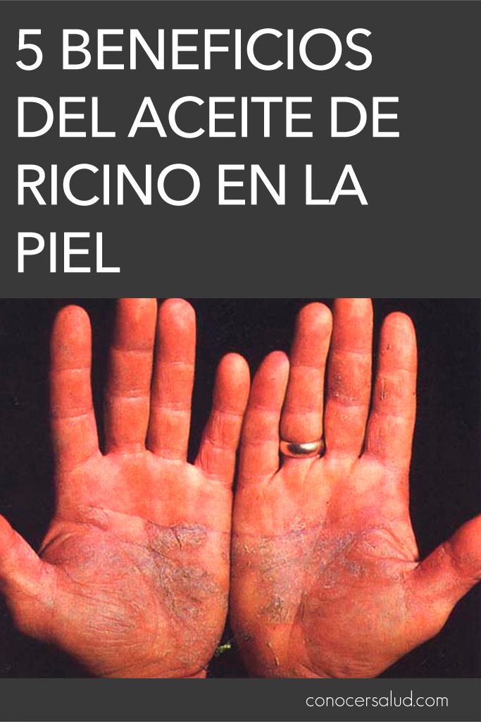 5 beneficios del aceite de ricino en la piel y maneras de utilizarlo para los problemas de la piel