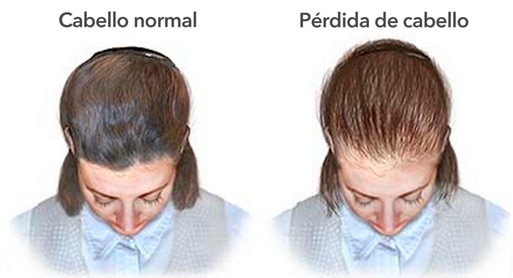 11 razones por las que tu cabello deja de crecer y se vuelve delgado