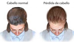 11 razones por las que tu cabello deja de crecer y se vuelve delgado