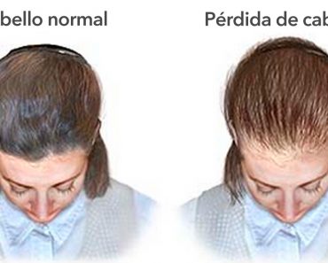 11 razones por las que tu cabello deja de crecer y se vuelve delgado