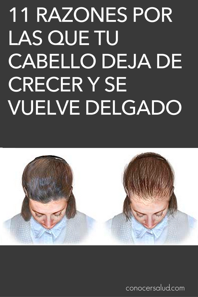 11 razones por las que tu cabello deja de crecer y se vuelve delgado