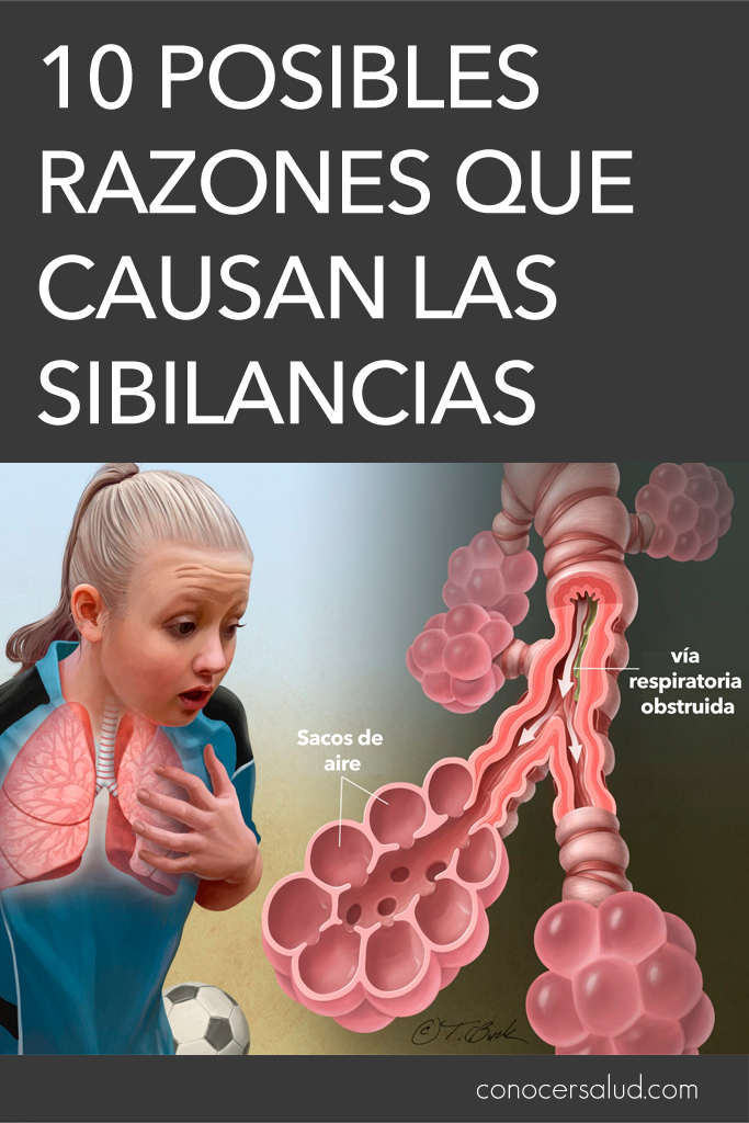 10 Posibles razones que causan las sibilancias