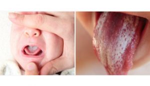 Algunos consejos fáciles para limpiar la lengua (y el resto de la boca) de su bebé