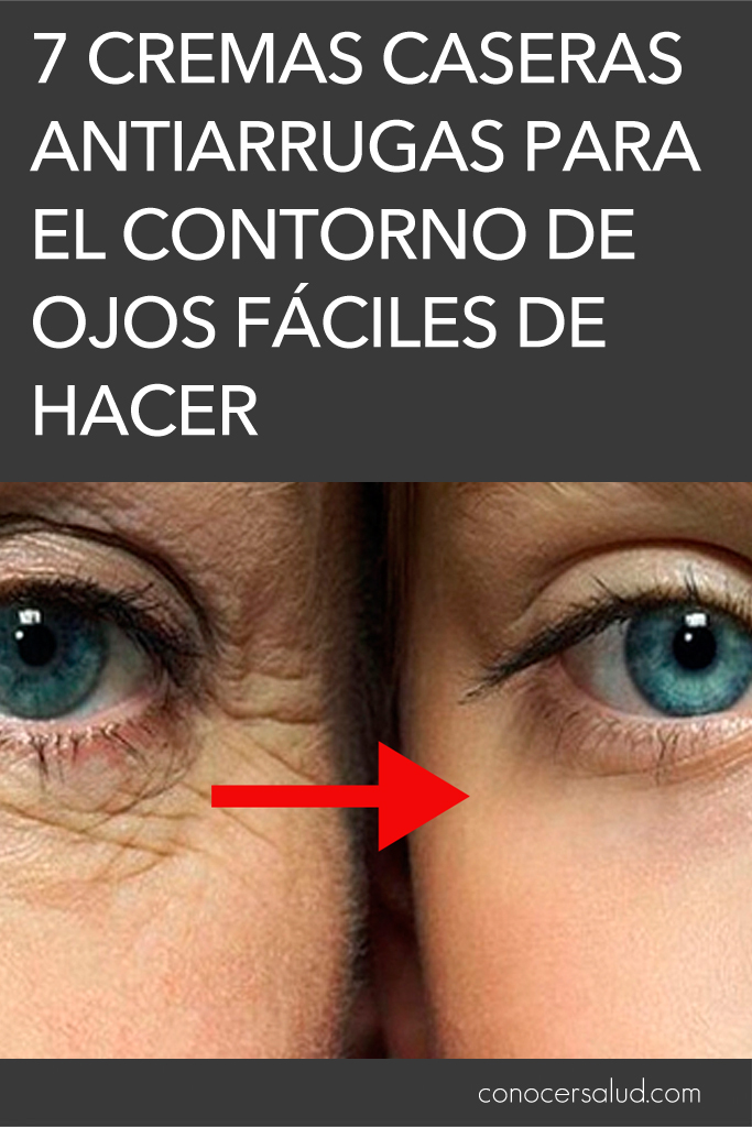 7 cremas caseras antiarrugas para el contorno de ojos fáciles de hacer