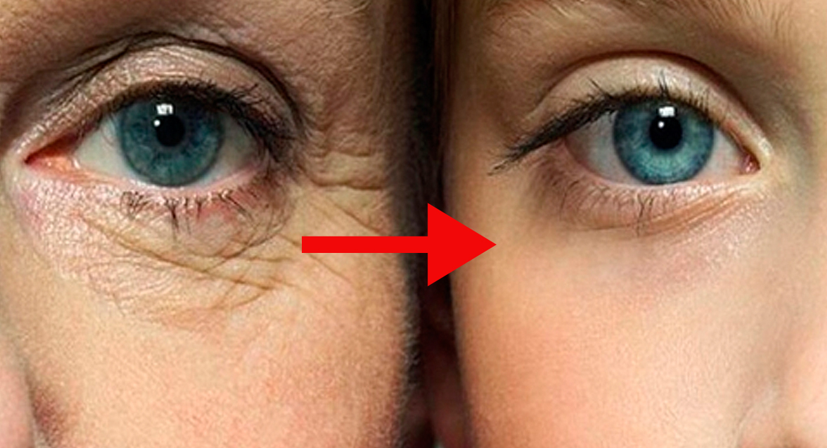 7 cremas caseras antiarrugas para el contorno de ojos