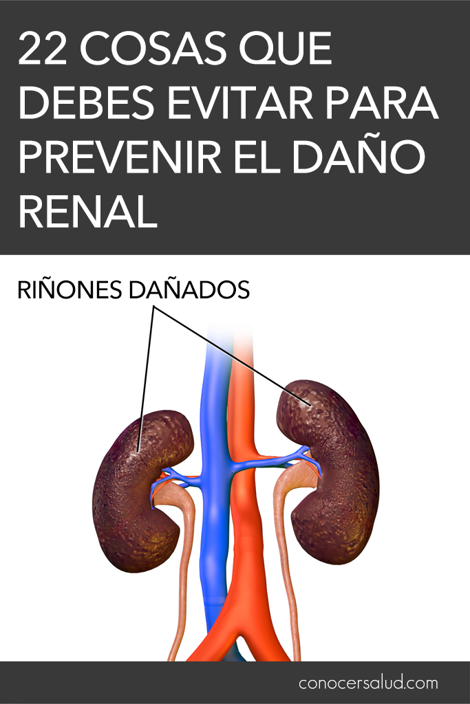 22 cosas que debes evitar para prevenir el daño renal