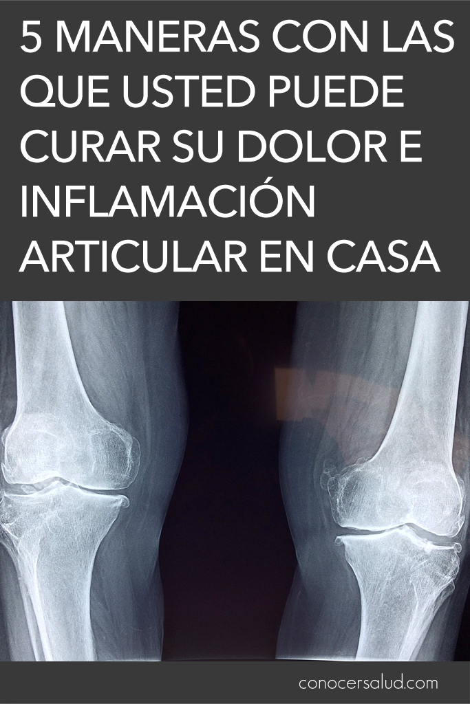 5 maneras con las que usted puede curar su dolor e inflamación articular en casa