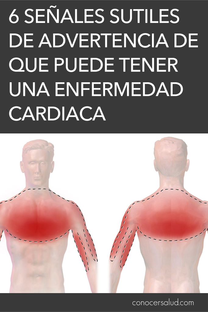 6 señales sutiles de advertencia de que puede tener una enfermedad cardiaca