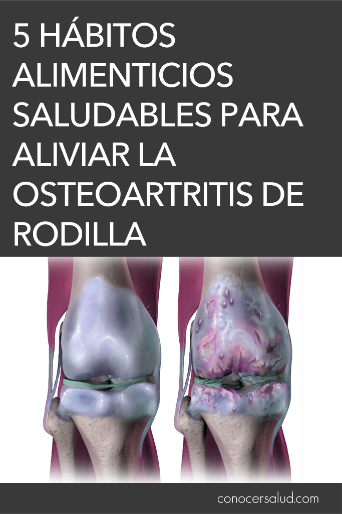 5 Hábitos alimenticios saludables para aliviar la osteoartritis de rodilla