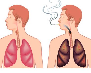 Cómo eliminar la nicotina de su cuerpo naturalmente