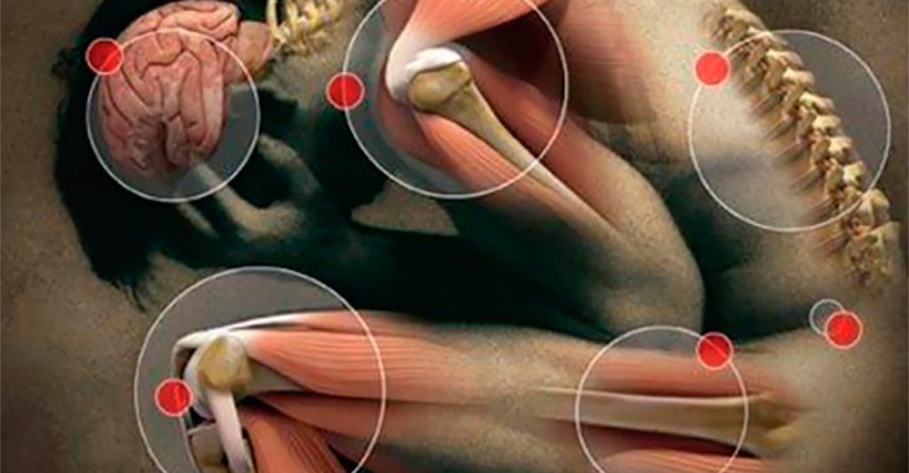 9 dolores y dolencias físicas asociadas con el estrés y las emociones