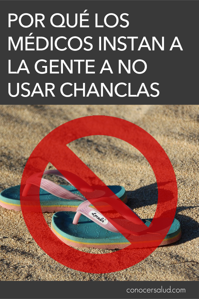 Por qué los médicos instan a la gente a no usar chanclas