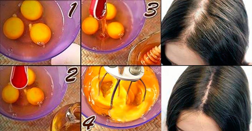5 maneras fáciles de usar huevos para tratar la pérdida de cabello